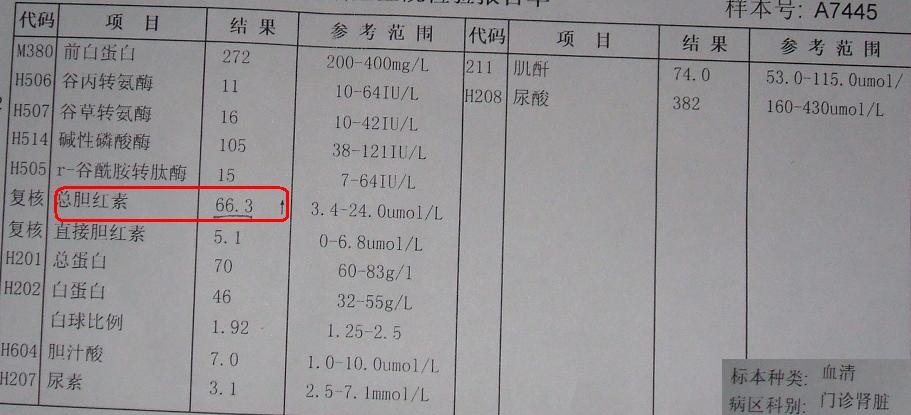 [求助]总胆红素超标2倍,直接胆红素正常(有化验单)