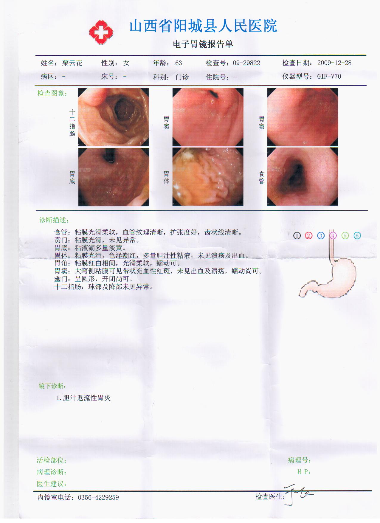 半夏瀉心湯加味治療膽汁反流性胃炎114例療效觀察